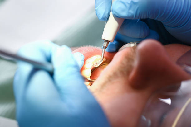 Best Emergency Treatment for Dental Infections or Abscesses in Royal Hawaiian Estates, HI